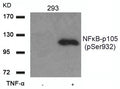 Western blot analysis of extracts from 293 cells untreated or treated with TNF-a using NFkB-p105(Phospho-Ser932) Antibody.