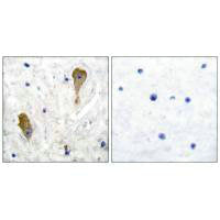 Immunohistochemical analysis of paraffin-embedded human brain tissue using GAD67 antibody.