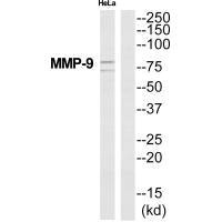 Western blot analysis of extracts from HeLa cells, using MMP-9 antibody.