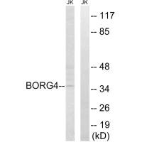 Western blot analysis of extracts from Jurkat cells, using BORG4 antibody.