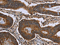 FHIT Antibody – Figure 1 of 2
