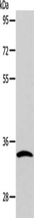 Gel: 10%SDS-PAGE, Lysate: 40 ug, Lane: Mouse stomach tissue, Primary antibody: CSB-PA143409(CASP6 Antibody) at dilution 1/100, Secondary antibody: Goat anti rabbit IgG at 1/8000 dilution, Exposure time: 40 seconds