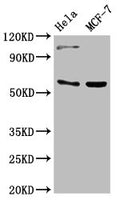 Western Blot
Positive WB detected in: Hela whole cell lysate, MCF-7 whole cell lysate
All lanes: RUNX2 antibody at 3ug/ml
Secondary
Goat polyclonal to rabbit IgG at 1/50000 dilution
Predicted band size: 57, 56, 55 kDa
Observed band size: 57 kDa