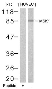 Western blot analysis of extracts from HUVEC cells using MSK1(Ab-376) Antibody and the same antibody preincubated with blocking peptide.