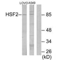 Western blot analysis of extracts from LOVO cells and A549 cells, using HSF2 antibody.