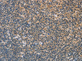 The image on the left is immunohistochemistry of paraffin-embedded Human tonsil tissue using CSB-PA145330(FXYD1 Antibody) at dilution 1/60, on the right is treated with fusion protein. (Original magnification: ×200)