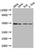 Western Blot
Positive WB detected in: recombinant protein
All lanes: Tet Antibody at 1:1000
Secondary
Goat polyclonal to rabbit IgG at 1/50000 dilution
Predicted band size: 47 kDa
Observed band size: 47 kDa