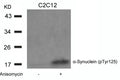 Western blot analysis of extracts from C2C12 cells untreated or treated with Anisomycin using a-Synuclein(Phospho-Tyr125) Antibody.