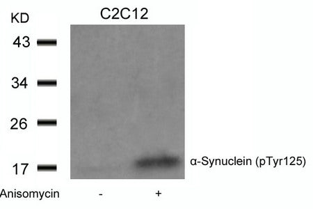 Western blot analysis of extracts from C2C12 cells untreated or treated with Anisomycin using a-Synuclein(Phospho-Tyr125) Antibody.