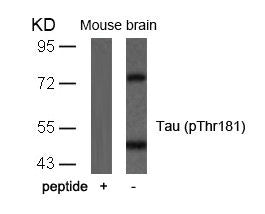 Western blot analysis of extracts from mouse brain tissue using Tau(Phospho-Thr181) Antibody and the same antibody preincubated with blocking peptide.