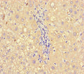 Immunohistochemistry of paraffin-embedded human liver tissue using CSB-PA14579A0Rb at dilution of 1:100