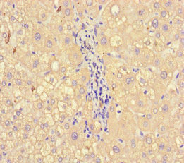 Immunohistochemistry of paraffin-embedded human liver tissue using CSB-PA14579A0Rb at dilution of 1:100