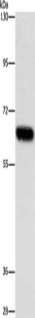 Gel: 6%SDS-PAGE, Lysate: 40 ug, Lane: Human plancenta tissue, Primary antibody: CSB-PA145915(ARSF Antibody) at dilution 1/216.7, Secondary antibody: Goat anti rabbit IgG at 1/8000 dilution, Exposure time: 40 seconds