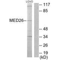 Western blot analysis of extracts from LOVO cells, using MED26 antibody.