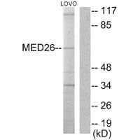 Western blot analysis of extracts from LOVO cells, using MED26 antibody.