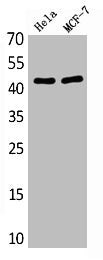 Western Blot analysis of various cells using Antibody diluted at 1:1000. Secondary antibody  was diluted at 1:20000