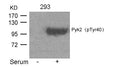 Western blot analysis of extracts from 293 cells untreated or treated with Serum using Pyk2(Phospho-Tyr402) Antibody.
