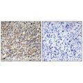 Immunohistochemistry analysis of paraffin-embedded human liver carcinoma tissue using COX17 antibody.