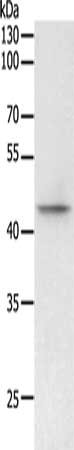 Gel: 10%SDS-PAGE, Lysate: 50 ug, Lane: 293T cells, Primary antibody: CSB-PA147848(PHF6 Antibody) at dilution 1/200, Secondary antibody: Goat anti rabbit IgG at 1/8000 dilution, Exposure time: 5 minutes