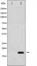 Western blot analysis of extracts from COLO cells, using Caspase 3 (p17,Cleaved-Asp175) Antibody. The lane on the left is treated with the synthesized peptide.