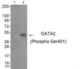 Western blot analysis of extracts from JK cells (Lane 2), using GATA2 (Phospho-Ser401) Antibody. The lane on the left is treated with antigen-specific peptide.