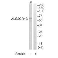 Western blot analysis of extracts from Jurkat cells, using ALS2CR13 antibody.