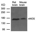 Western blot analysis of extracts from Rat and Mouse brain tissue using nNOS(Ab-852) Antibody.