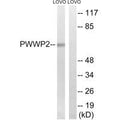 Western blot analysis of extracts from LOVO cells, using PWWP2B antibody.