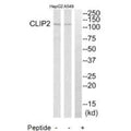 Western blot analysis of extracts from HepG2 cells and A549 cells, using CLIP2 antibody.