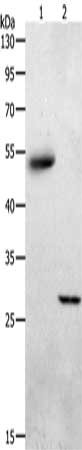 Gel: 10%SDS-PAGE, Lysate: 40 ug, Lane 1-2: Human liver cancer tissue, mouse skeletal muscle tissue, Primary antibody: CSB-PA149289(ADIPOQ Antibody) at dilution 1/550, Secondary antibody: Goat anti rabbit IgG at 1/8000 dilution, Exposure time: 2 minutes