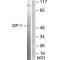 Western blot analysis of extracts from HeLa cells, using DP-1 antibody.