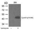 Western blot analysis of extracts from 293 cells untreated or treated with hydroxyurea using Cyclin E1(phospho-Thr395) Antibody.