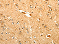 The image on the left is immunohistochemistry of paraffin-embedded Human brain tissue using CSB-PA150036(PTPN6 Antibody) at dilution 1/40, on the right is treated with fusion protein. (Original magnification: ×200)