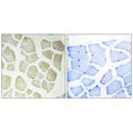 Immunohistochemistry analysis of paraffin-embedded human skeletal muscle tissue, using CDKL3 antibody.