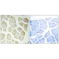 Immunohistochemistry analysis of paraffin-embedded human skeletal muscle tissue, using CDKL3 antibody.