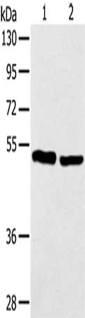 Gel: 12%SDS-PAGE, Lysate: 40 ug, Lane 1-2: Human breast tissue, Human colon cancer tissue, Primary antibody: CSB-PA150453(TP53 Antibody) at dilution 1/300, Secondary antibody: Goat anti rabbit IgG at 1/8000 dilution, Exposure time: 60 seconds