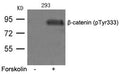 Western blot analysis of extracts from 293 cells untreated or treated with FSK using b-catenin(phospho-Tyr333) Antibody.