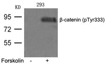 Western blot analysis of extracts from 293 cells untreated or treated with FSK using b-catenin(phospho-Tyr333) Antibody.