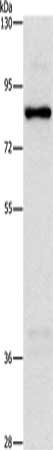 Gel: 10%SDS-PAGE, Lysate: 40 ug, Lane: Hela cells, Primary antibody: CSB-PA150875(NOL9 Antibody) at dilution 1/1250, Secondary antibody: Goat anti rabbit IgG at 1/8000 dilution, Exposure time: 5 seconds