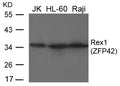 Western blot analysis of extracts from JK, HL-60 and Raji cells using Rex1(ZFP42) Antibody.