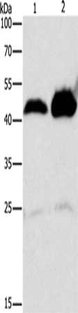 Gel: 10%SDS-PAGE, Lysate: 40 ug, Lane 1-2: 293T cells, mouse intestinum tenue tissue, Primary antibody: CSB-PA152141(ADK Antibody) at dilution 1/100, Secondary antibody: Goat anti rabbit IgG at 1/8000 dilution, Exposure time: 10 minutes