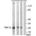 Western blot analysis of extracts from COLO cells, HUVEC cells and 293 cells, using TNF12 antibody.