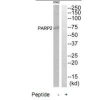 Western blot analysis of extracts from K562 and HuvEc cells, using PARP2 antibody.