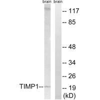 Western blot analysis of extracts from 293 cells, using TIMP1 antibody.