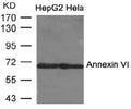 Western blot analysis of extracts from HepG2 andd Hela cells us ing Annexin VI Antibody.