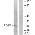 Western blot analysis of extracts from NIH/3T3 cells, using PDGFB antibody.
