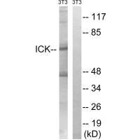 Western blot analysis of extracts from 3T3 cells, treated with PBS (10uM, 60mins), using ICK (Ab-159) antibody.