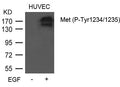 Western blot analysis of extracts from HUVEC cells untreated or treated with EGF using Met (Phospho-Tyr1234/1235) Antibody.