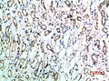 Immunohistochemical analysis of paraffin-embedded human-kidney, antibody was diluted at 1:200