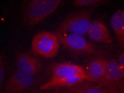Immunofluorescence staining of methanol-fixed Hela cells using Tyrosine Hydroxylase(Phospho-Ser40) Antibody.